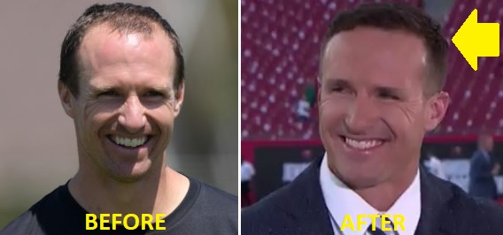 Drew Brees’ Hair: A New Look That Got Everyone Talking